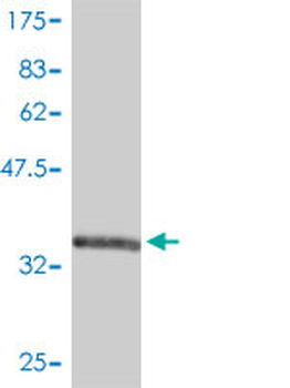FABP3 monoclonal antibody (M01), clone 4F6-1D6