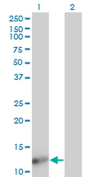 FABP4 monoclonal antibody (M08), clone 4D12