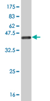 FABP4 monoclonal antibody (M08), clone 4D12