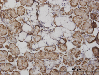 FABP4 monoclonal antibody (M05), clone 3G1