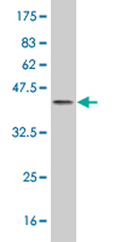 FABP4 monoclonal antibody (M05), clone 3G1