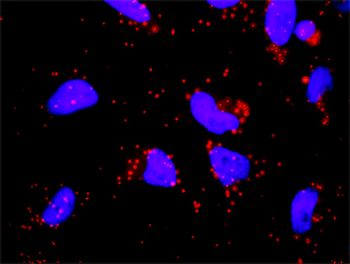 F12 monoclonal antibody (M01), clone 3A3