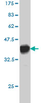 F12 monoclonal antibody (M01), clone 3A3