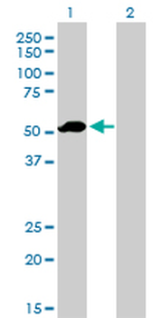 F9 monoclonal antibody (M01), clone 2C9
