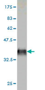 F9 monoclonal antibody (M01), clone 2C9