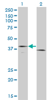 F3 monoclonal antibody (M01A), clone 4G4