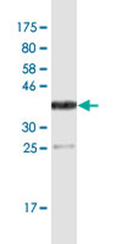 F3 monoclonal antibody (M01A), clone 4G4