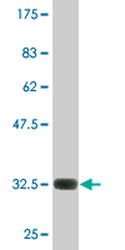 F2R monoclonal antibody (M01), clone 2C5