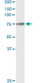 F2 monoclonal antibody (M01), clone 1B7