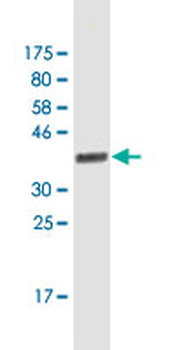 EZH2 monoclonal antibody (M01), clone 2C3