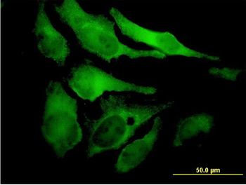 EYA2 monoclonal antibody (M04), clone 2F8