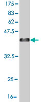EYA2 monoclonal antibody (M04), clone 2F8
