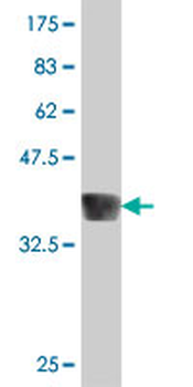 EYA1 polyclonal antibody (A01)