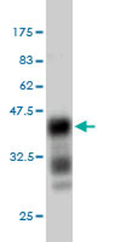 EXT1 monoclonal antibody (M01), clone 5A5