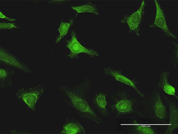 EXT1 purified MaxPab rabbit polyclonal antibody (D01P)