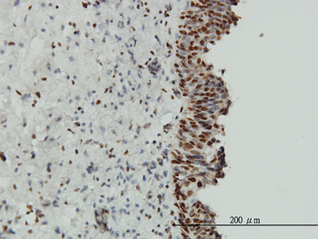 EWSR1 monoclonal antibody (M01), clone 5C10