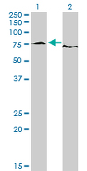 EWSR1 monoclonal antibody (M01), clone 5C10