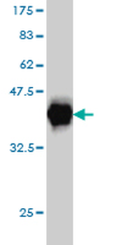EWSR1 monoclonal antibody (M01), clone 5C10