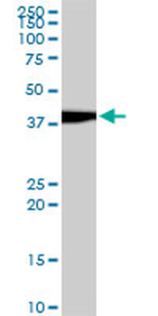 EVX1 monoclonal antibody (M07), clone 1B7