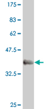 EVX1 monoclonal antibody (M07), clone 1B7