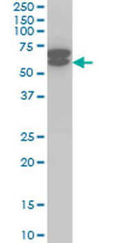 ETV6 monoclonal antibody (M01), clone 3B10