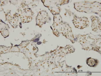 ETV6 monoclonal antibody (M01), clone 3B10