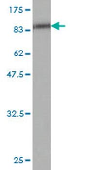 ETV6 monoclonal antibody (M01), clone 3B10