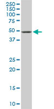 ETV5 monoclonal antibody (M02), clone 7C10