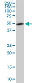ETV5 monoclonal antibody (M02), clone 7C10