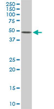 ETV5 monoclonal antibody (M02), clone 7C10
