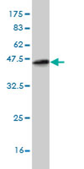 ETV5 monoclonal antibody (M02), clone 7C10