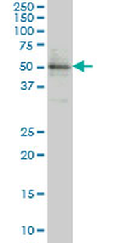 ETV5 monoclonal antibody (M01), clone 3B10