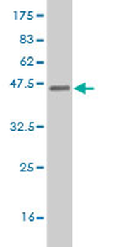ETV5 monoclonal antibody (M01), clone 3B10