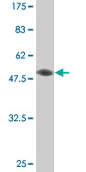ETV4 monoclonal antibody (M02), clone 1A3-1D3