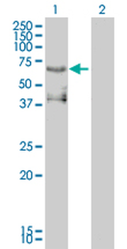 ETV4 monoclonal antibody (M01), clone 3G9-1B9
