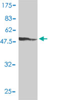ETV4 monoclonal antibody (M01), clone 3G9-1B9