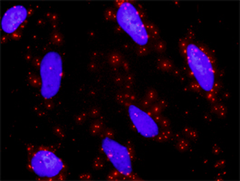 ETS1 purified MaxPab rabbit polyclonal antibody (D01P)