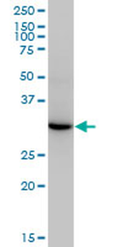 ESD monoclonal antibody (M01), clone 1E1
