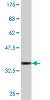 ESD monoclonal antibody (M01), clone 1E1