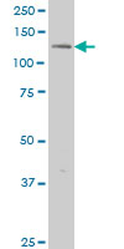 ERN1 monoclonal antibody (M06), clone 3D1