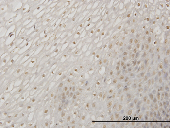 ERN1 monoclonal antibody (M06), clone 3D1