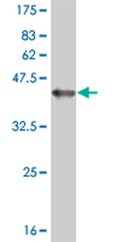 ERN1 monoclonal antibody (M06), clone 3D1