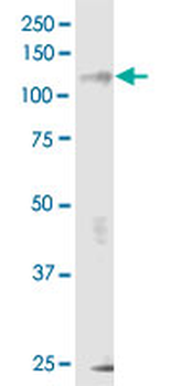 ERN1 monoclonal antibody (M02), clone 8D12