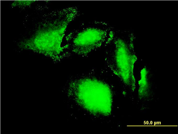 ERN1 monoclonal antibody (M02), clone 8D12