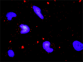 ERN1 monoclonal antibody (M02), clone 8D12
