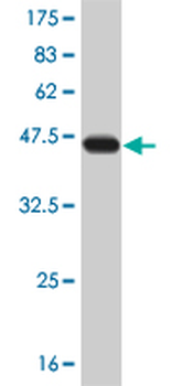 ERN1 monoclonal antibody (M02), clone 8D12