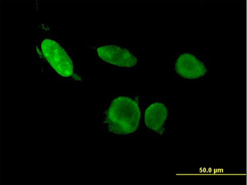 ERF monoclonal antibody (M02), clone 3F11