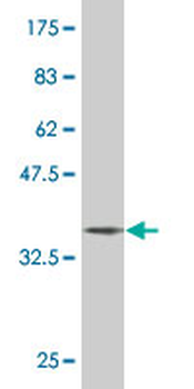 ERF monoclonal antibody (M02), clone 3F11
