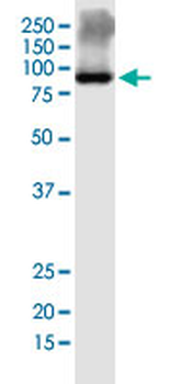 ERCC2 monoclonal antibody (M01J), clone 4G2-2A6