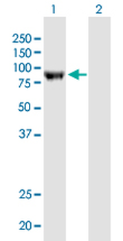 ERCC2 monoclonal antibody (M01J), clone 4G2-2A6